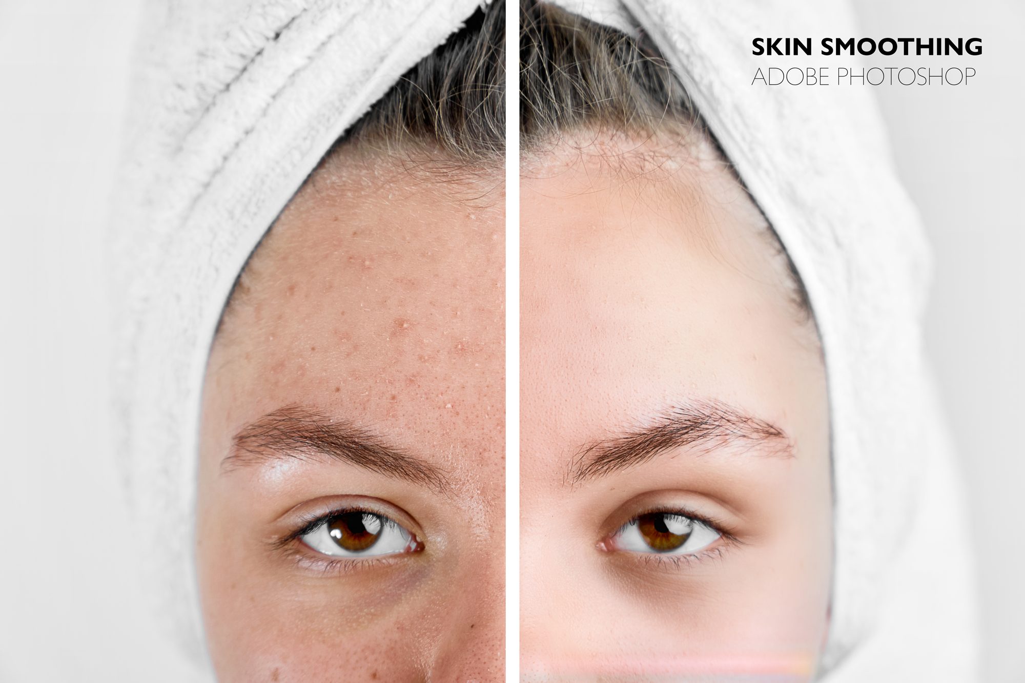 Skin Smoothing: Removing Acne and Blemishes in Adobe Photoshop